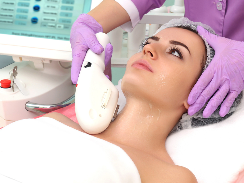 IPL – Luz Pulsada Intensa